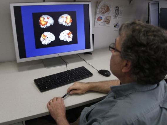Scientist looking at scans of a human brain on a computer