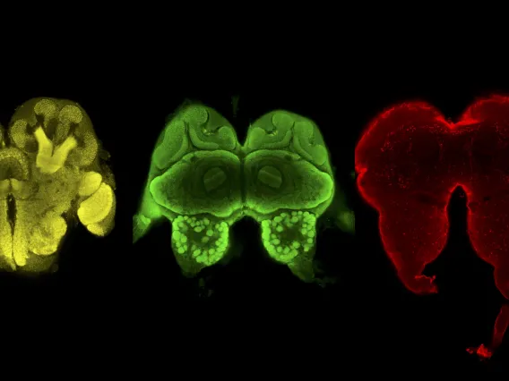 Imaging of ant brains