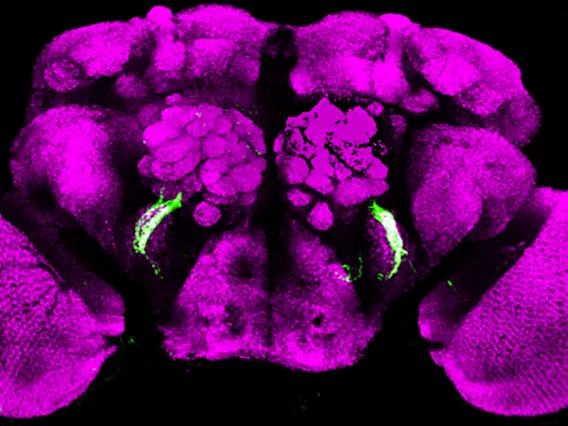 Photo of a section of the brain