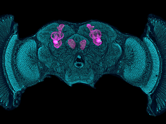 Medical imaging of drosophila mushroom bodies