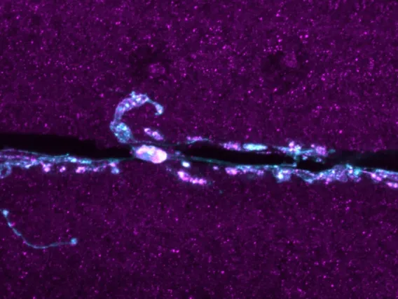 Brain cells viewed through imaging technology