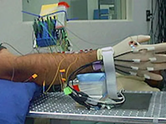 Human hand hooked up to wires for study on paralyzed limbs