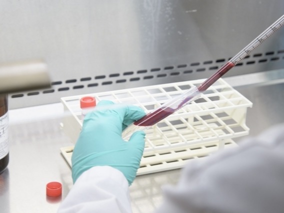 Scientist putting blood sample in a vile