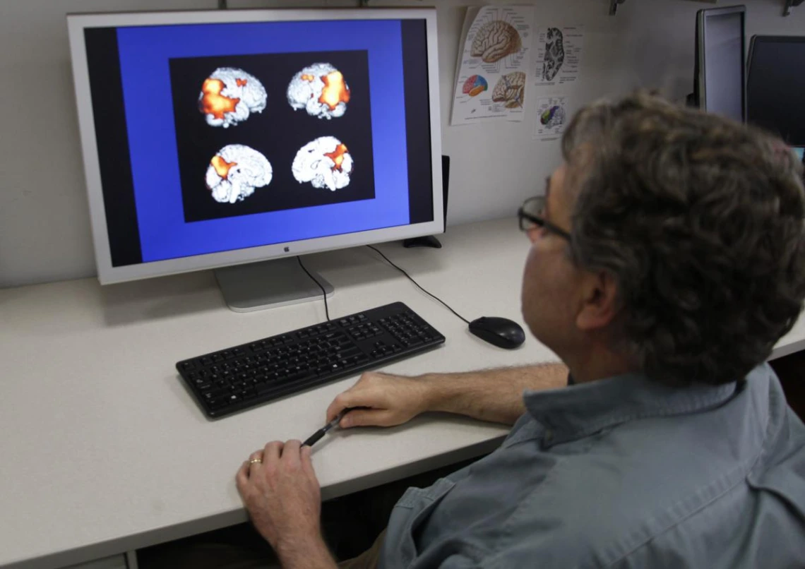 Scientist looking at scans of a human brain on a computer