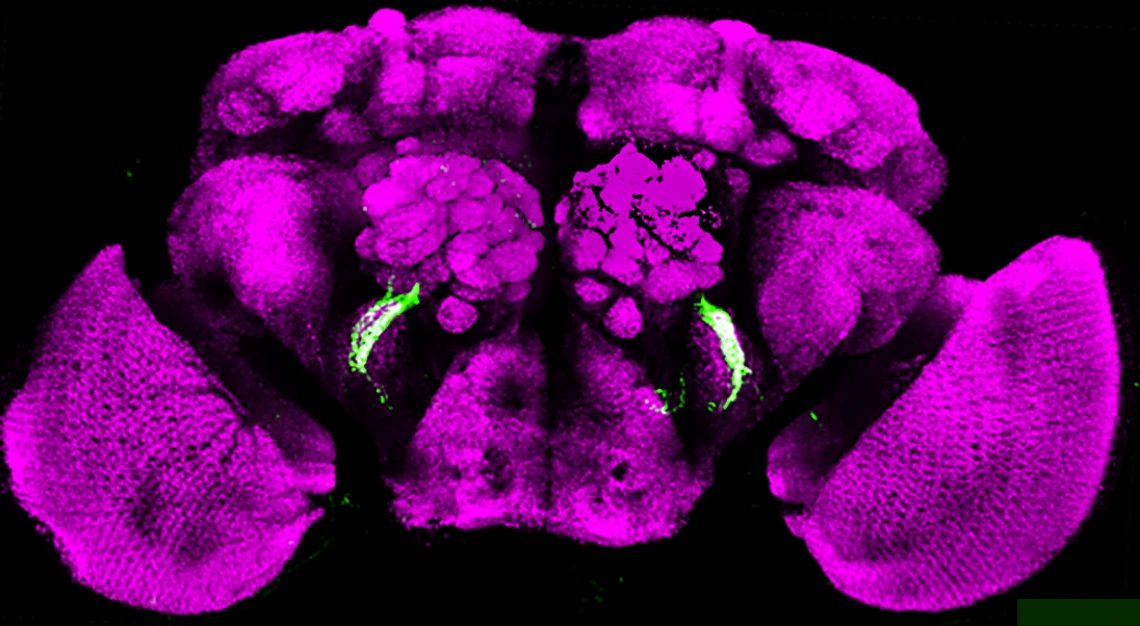 Photo of a section of the brain