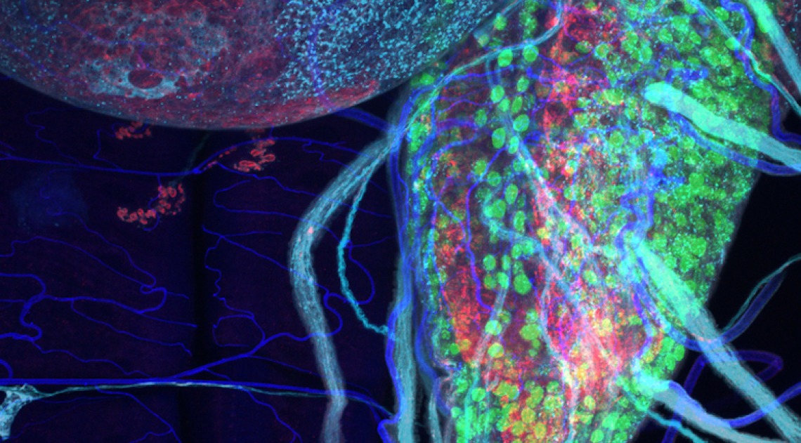 Close up photo of ALS neurons