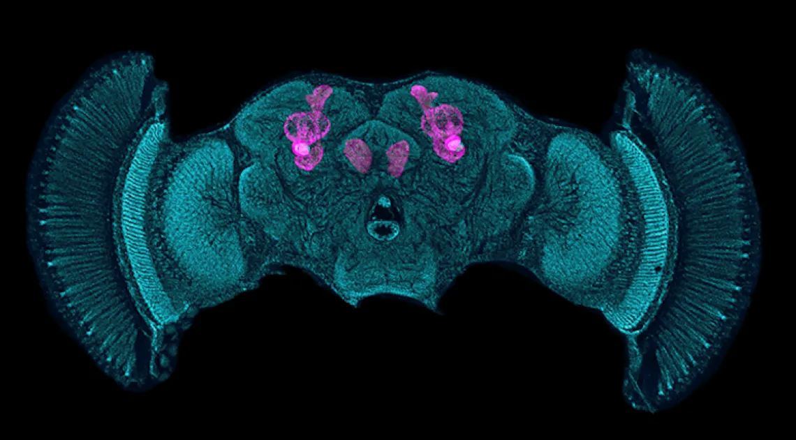 Medical imaging of drosophila mushroom bodies