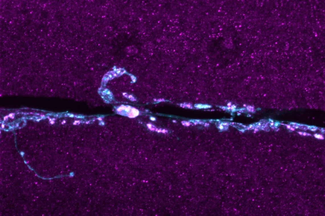 Brain cells viewed through imaging technology