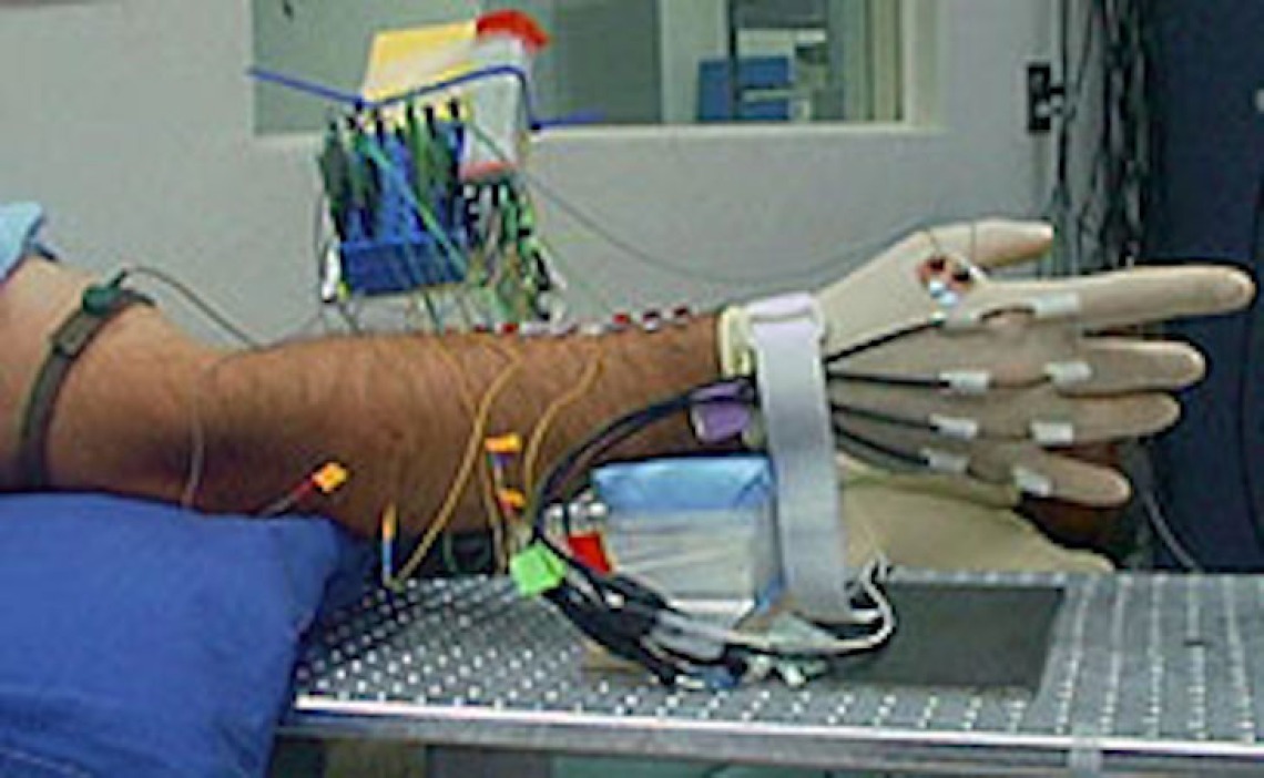 Human hand hooked up to wires for study on paralyzed limbs