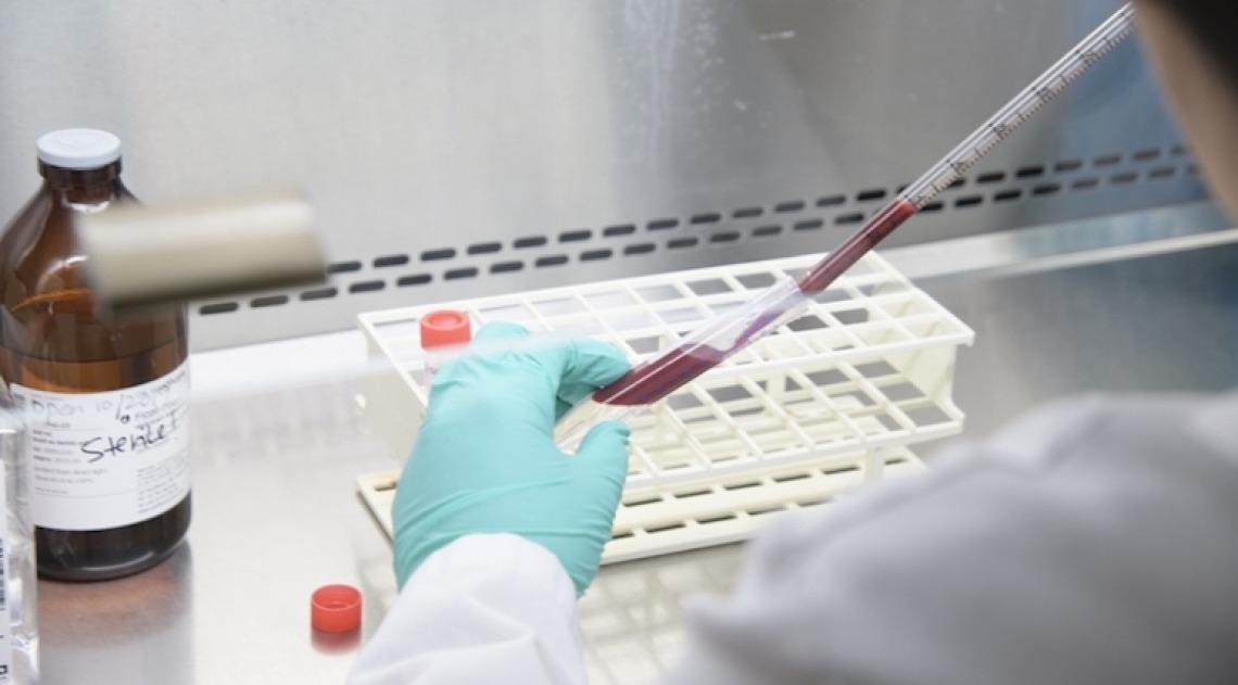 Scientist putting blood sample in a vile